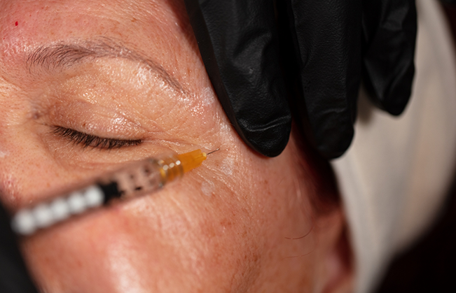 Close up of a person getting an injection next to their eye