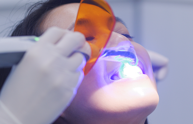Dental patient having cosmetic bonding applied to their teeth