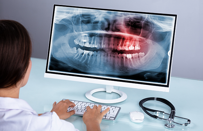 Dentist looking at an x ray of a patient's teeth