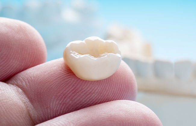Dental crown resting on a person's finger