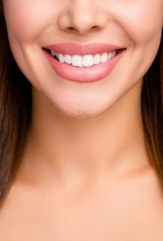 Nose-to-shoulder view of woman smiling with perfect teeth