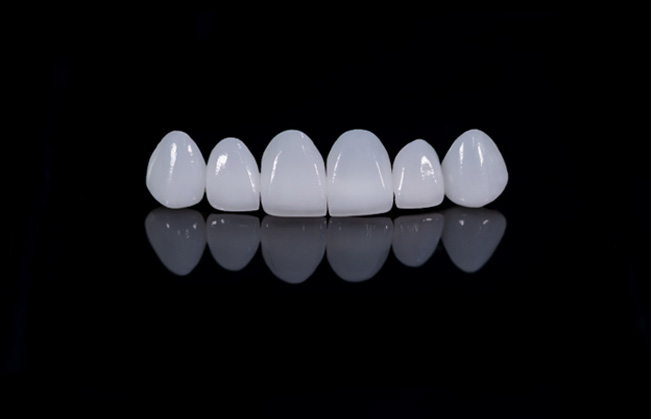 Set of veneers on black, reflective surface