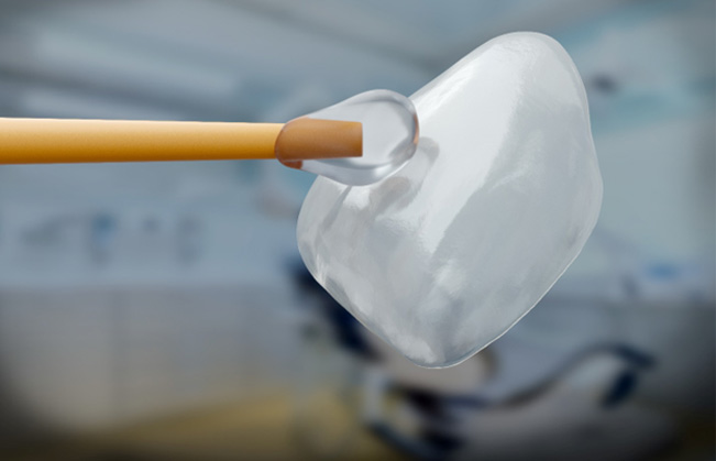 Closeup of veneer being held on toothpick with clear glue
