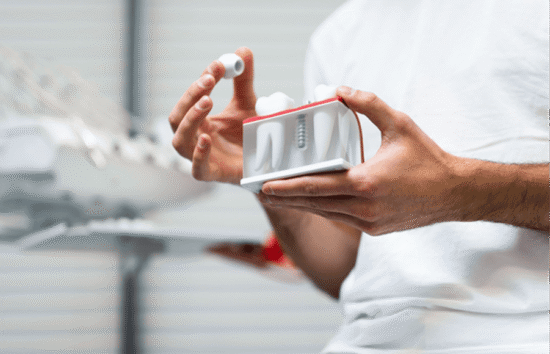 dental implants in maple valley